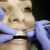 Ile czasu trwa leczenie ortodontyczne?